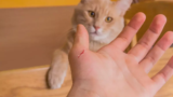 How can one scratch fever be treated – Credihealth Blog
